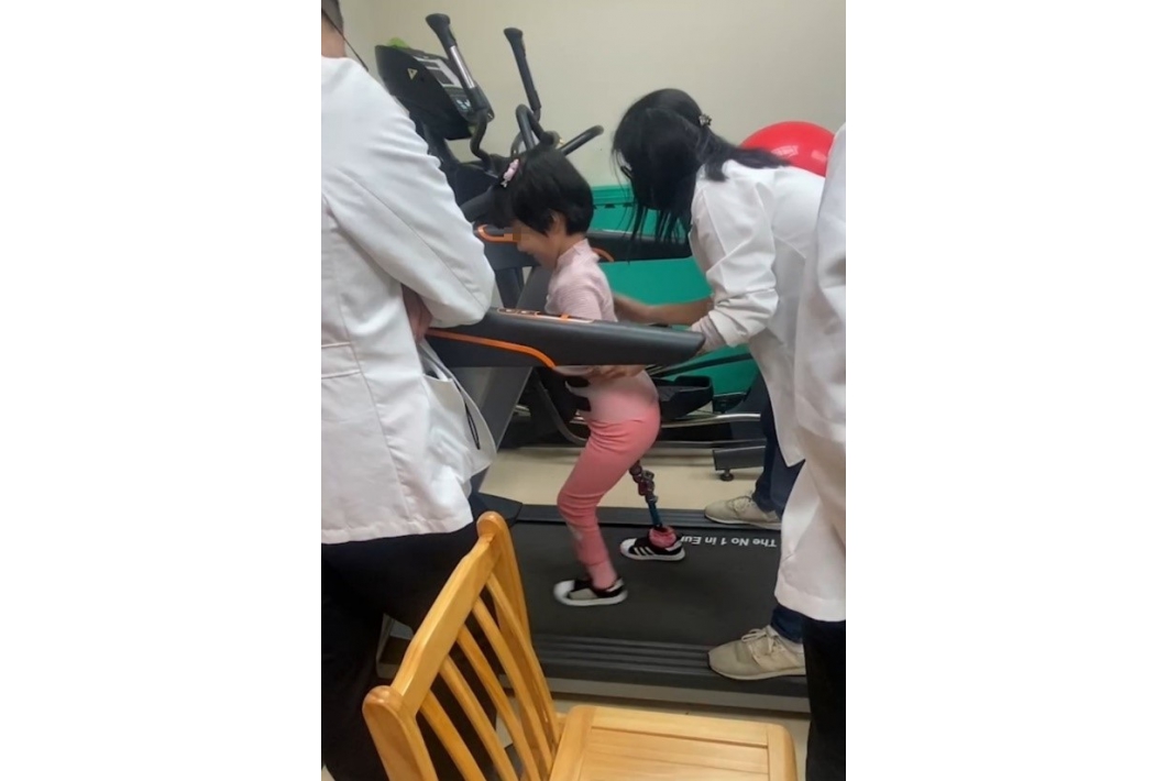 新髖離斷義肢使用良好